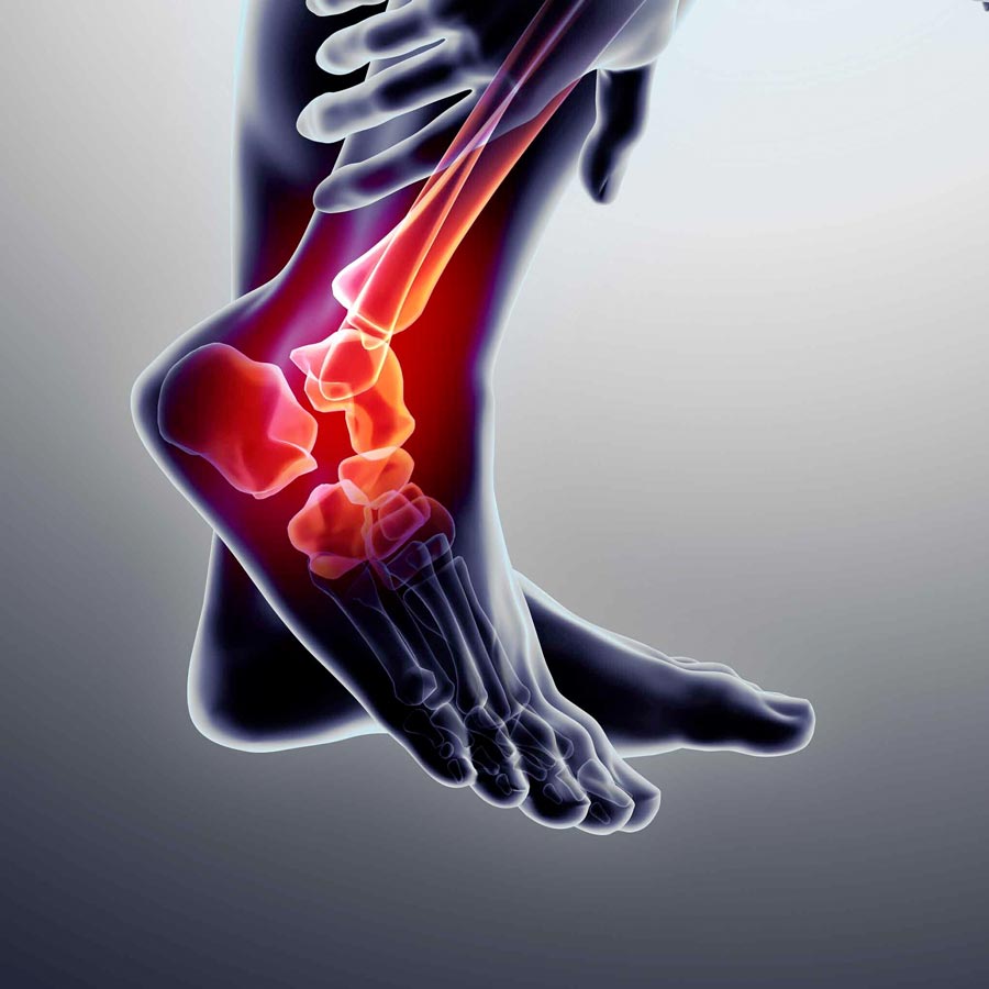 Long-Term Solutions for Foot & Ankle Pain